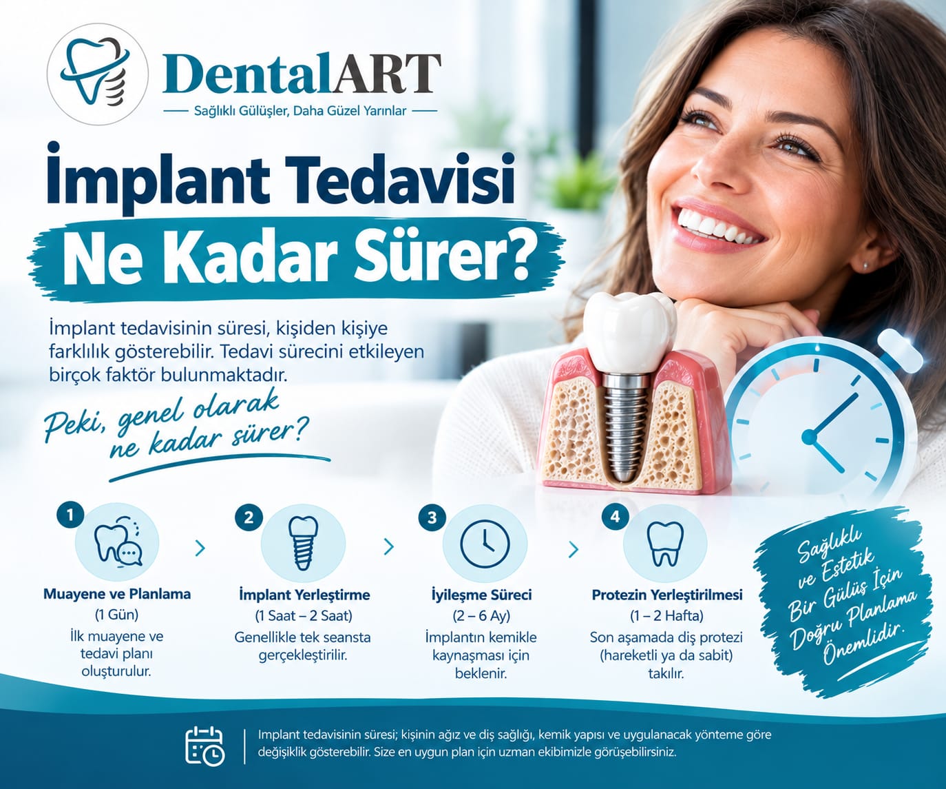 İmplant Tedavisi Ne Kadar Sürer?