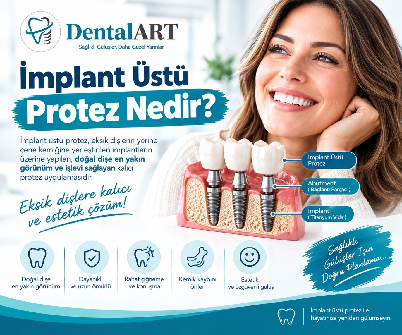 İmplant Üstü Protez Nedir? | Dentalart