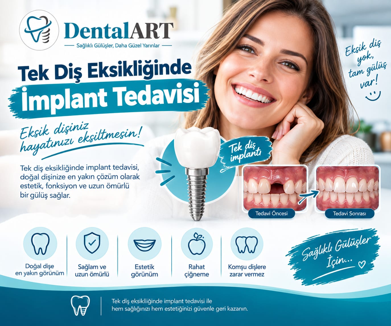 Tek Diş Eksikliğinde İmplant Tedavisi