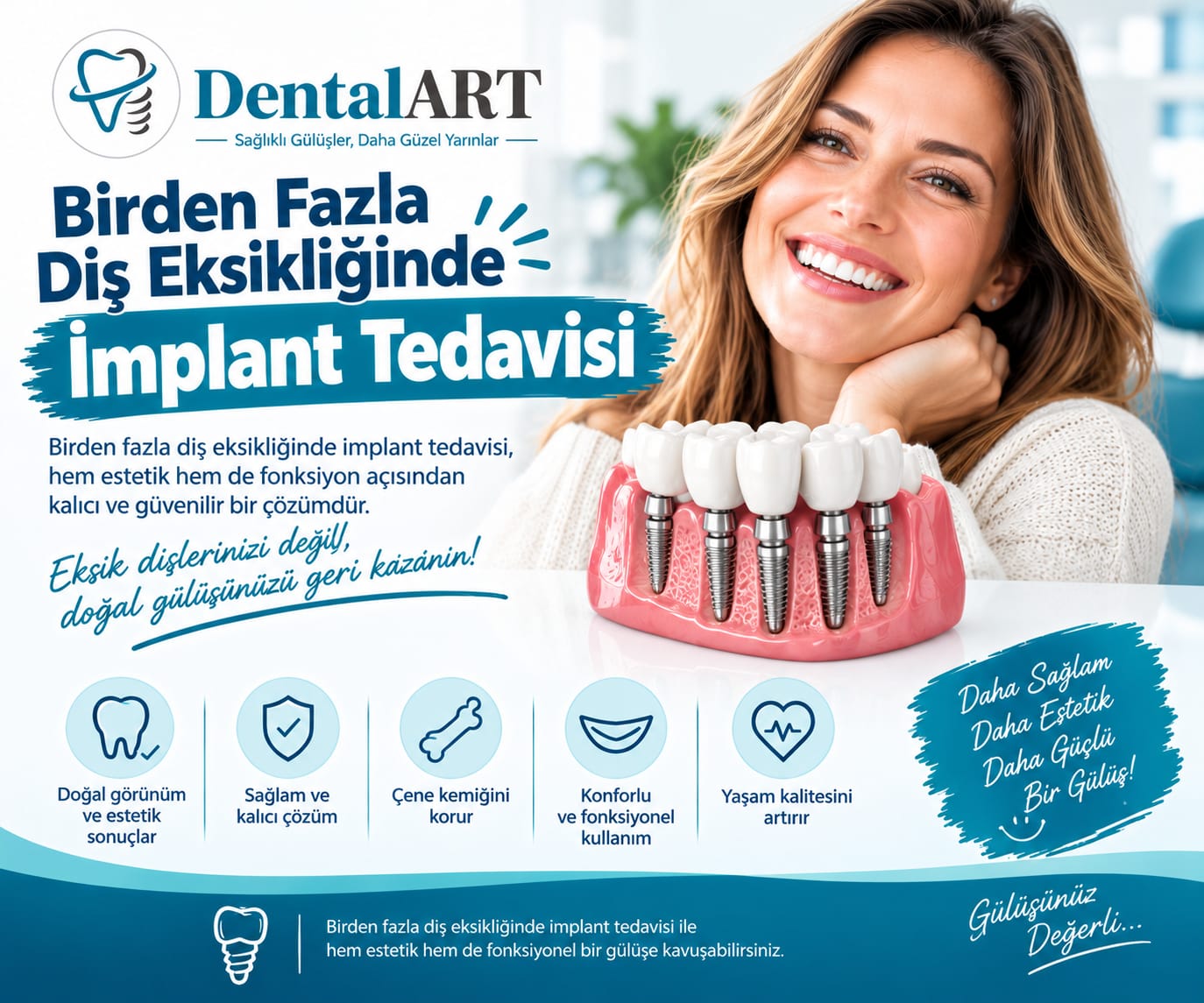 Birden Fazla Diş Eksikliğinde İmplant Tedavisi